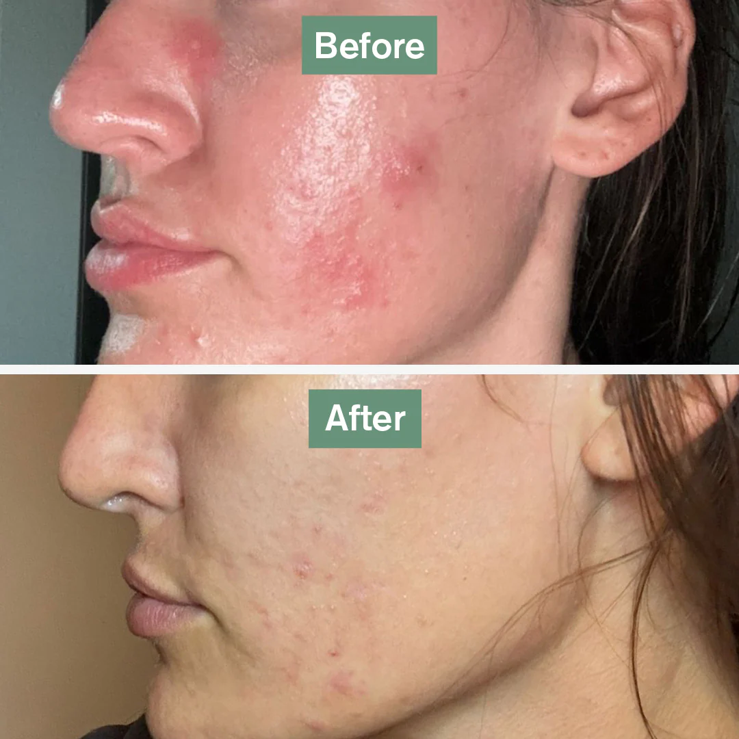 Skin Saviour® - Image 5