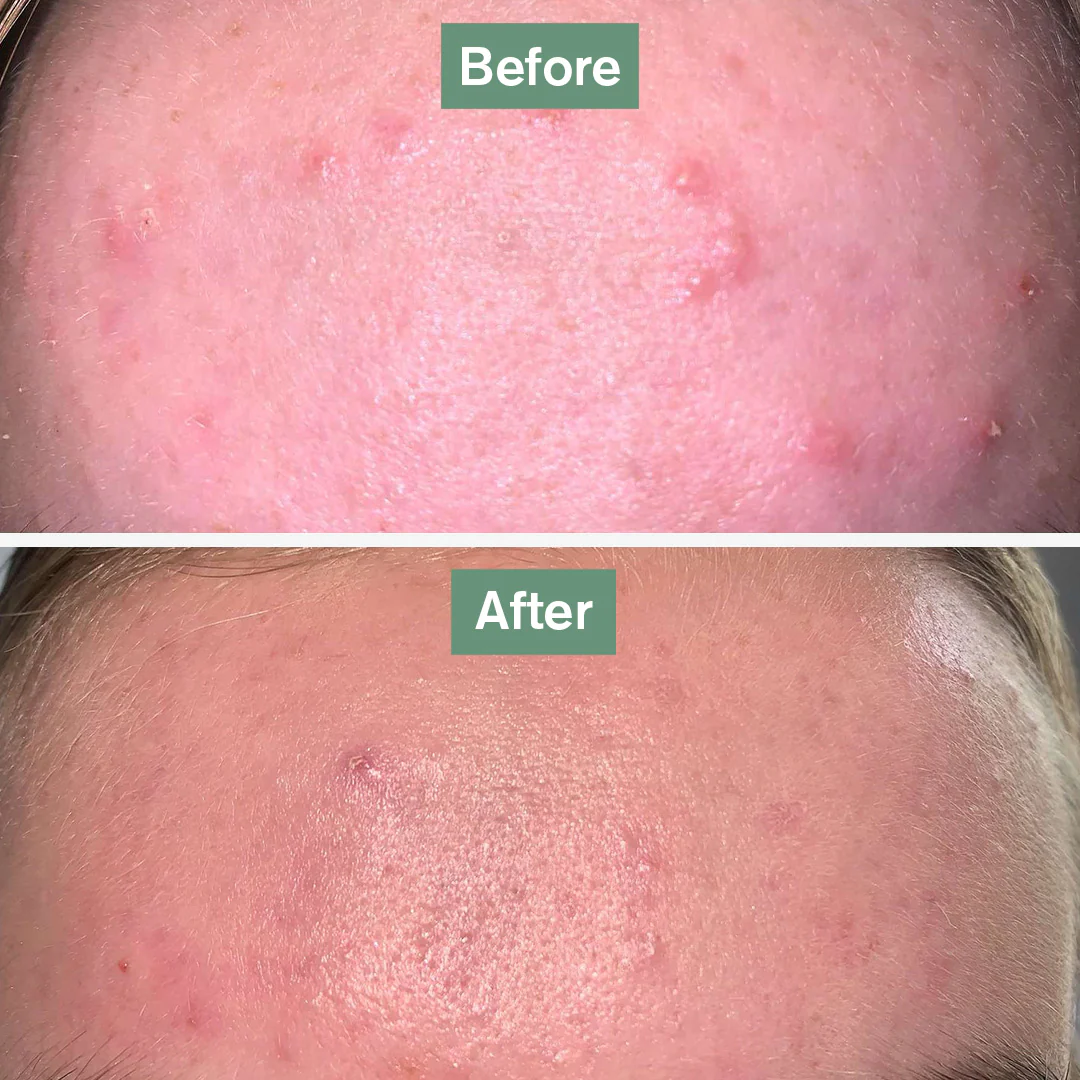 Skin Saviour® - Image 6